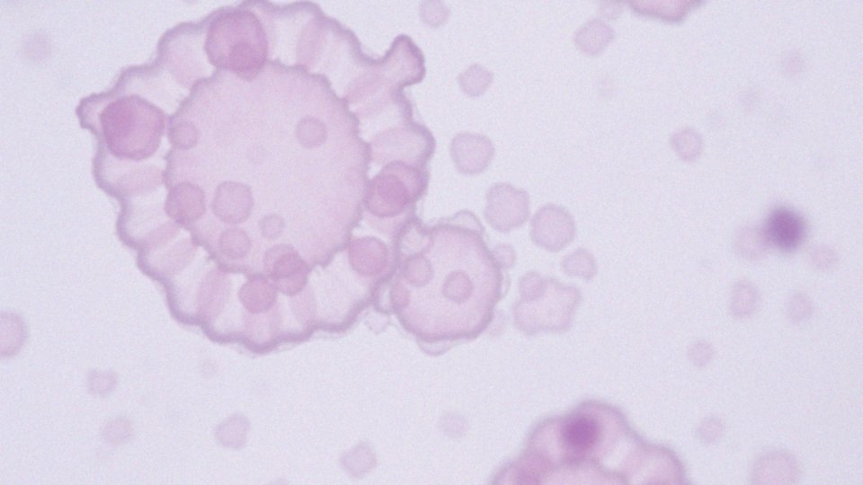 Ektocervix – co to jest i jakie ma znaczenie dla zdrowia kobiet?